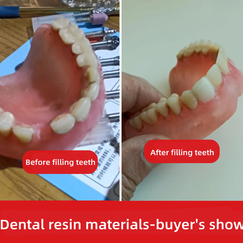 filling teeth material